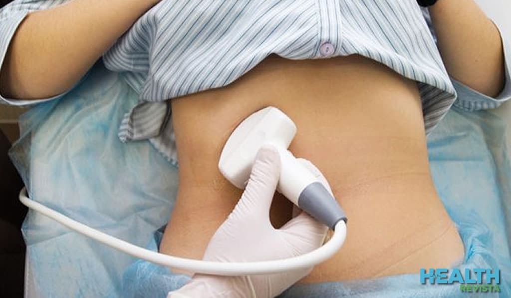Histeroscopia y ecografía: Cómo se diagnostican los pólipos uterinos