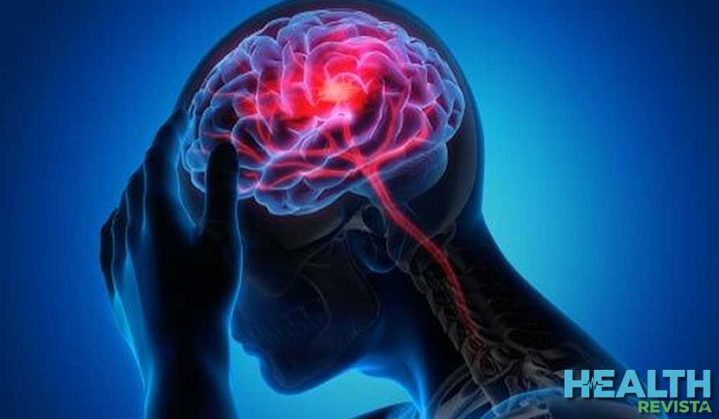 El efecto de masa y la toxicidad del hierro libre: Fisiopatología del daño cerebral primario y secundario en la hemorragia intracraneal