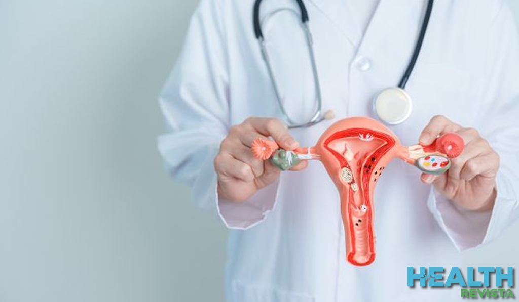 Síndrome de Ovario Poliquístico (SOP): Más allá de la regla irregular, el impacto metabólico, hormonal y reproductivo